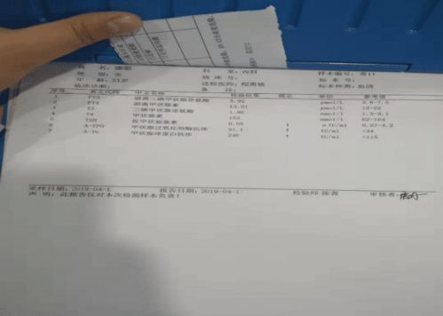 21岁少女初入事业单位,因这病入职体检后被告知 开除