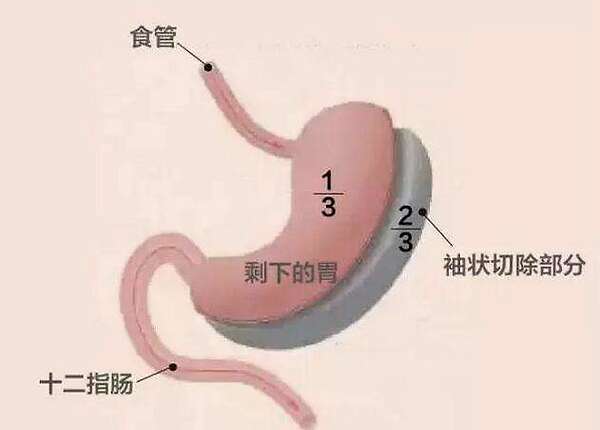 胃图片位置示意图 信息图文欣赏 信息村 K0w0m Com