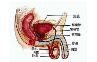 如何预防阴囊潮湿