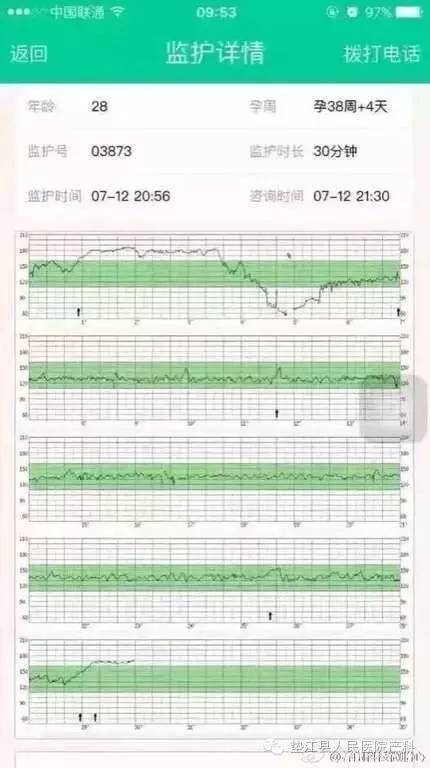 胎监正弦波图形 图片欣赏中心 急不急图文 Jpjww Com