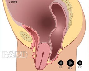 盆底康复该不该做 我来给您答案