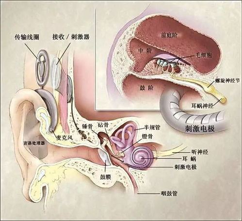 只为你聆听世界的美好 吉林大学中日联谊医院完成吉林省年龄最小聋儿双侧人工耳蜗手术 