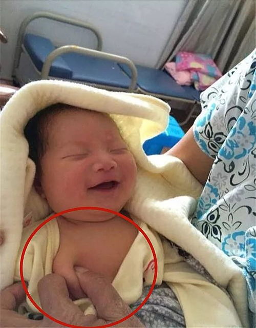 挤乳头...女婴出生20天被婆婆挤乳头,第二天娃紧急送医