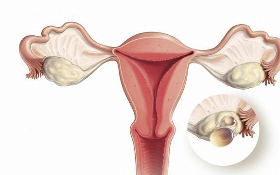 试管助孕过程，卵巢差AMH可以随时检查吗？