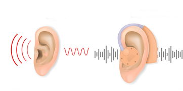 经常性耳鸣应该怎么办