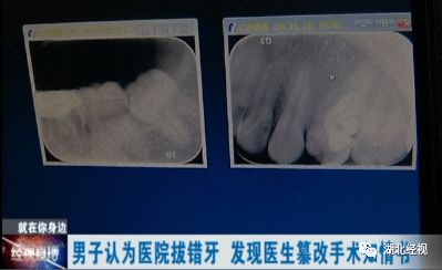 武汉男子质疑拔错牙,协商中竟发现手术知情书被篡改,当事医生回应