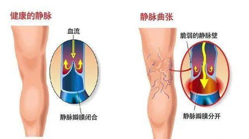 养腿就是养命, 衰老从腿开始