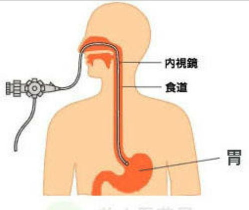 揭开肠胃健康的神秘面纱：全身热成像检查帮你轻松了解