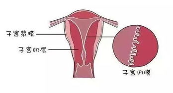 年轻女性子宫内膜厚,应该怎么办