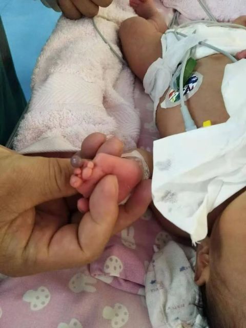 汉中一婴儿出生时缺了四根手指,两年后又奇迹长出,只因