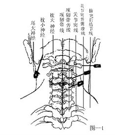 针刀治疗颈腰臀膝图解分解