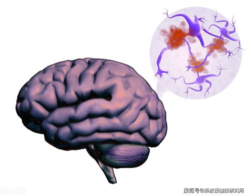 减脂不吃肉都是在做无用功,营养师说减脂更应该吃肉