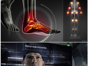 X光人体骨骼关节病痛医疗模板素材 高清格式下载 视频40.41MB 医疗教育 实拍视频大全 