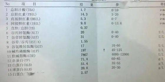 乙肝检查 乙肝需要做哪些检查