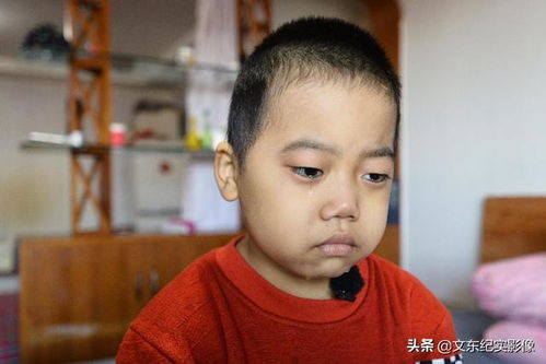 熊猫血男孩身患石骨症,病因不明,骨头基本钙化