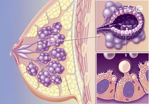女人该怎么预防,高发的乳腺增生及乳腺癌