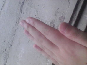 指甲很宽,尤其是大拇指 怎样可以使指甲看起来窄 长 