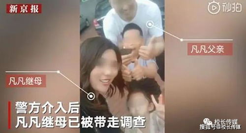 4岁女童遭 继母 殴打进ICU 没有人性的人,不配当人