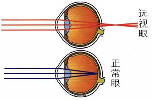 孩子的视力多少算正常 还不知道的家长看这里 