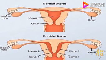 太罕见 女孩拥有2个子宫 这究竟是个什么梗 