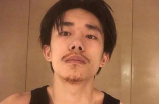 男人的胡子可以脱毛吗 男生胡子怎么永久去掉