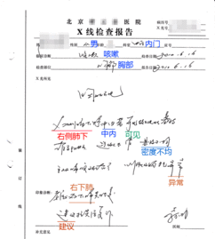 Quanto期权翻译成中文叫什么啊?