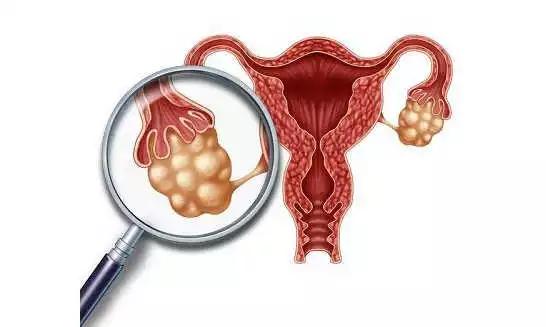 原创输卵管很脆弱，这几种问题尤须重视，呵护输卵管，这3点很有必要