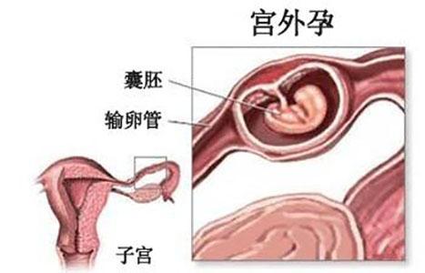 胚胎着床，怀孕着床是什么意思