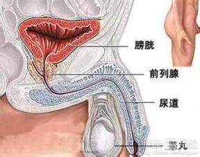 膀胱癌切除以后为什么还发烧