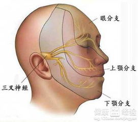 牙髓炎引起三叉神经痛怎么办