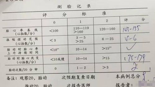 怀孕几周做胎心监护 上午好还是下午好 5招让胎心监护一次通过