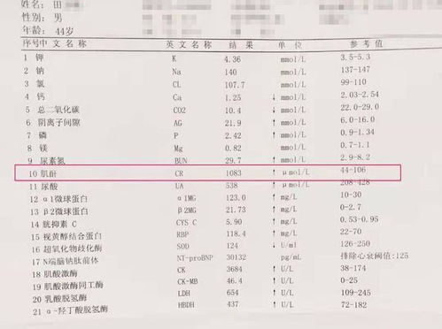 肌酐700以上就必须透析吗 且慢 别把肾功能透没了