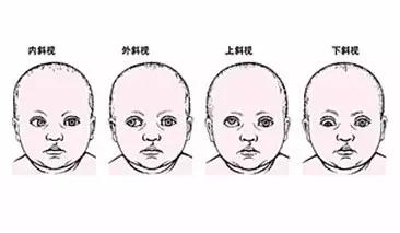 教你六个方法预防宝宝斜视,出现斜视也不用怕,我们有招