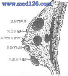 乳房脓肿切开引流术操作步骤,图片图谱图解,乳房手术治疗方法 