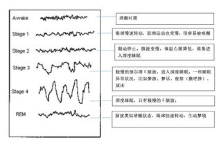 你有的晚上不做梦 这是个谎言