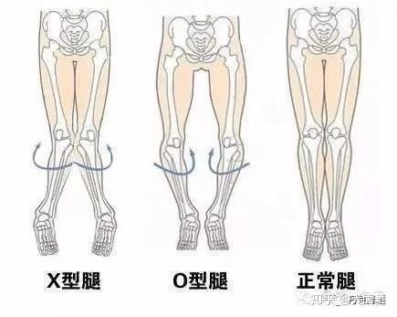 舞蹈训练干货 矫正O型腿,让腿更直更细更长 