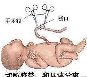 宝宝出生后不用剪脐带 世界上居然还有这么奇葩的生孩子方式