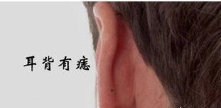耳朵不同位置有痣代表什么含义 耳朵有痣的女人命运好不好