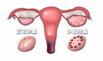 揭开妇科B超检查的7个小秘密 成都妇产科医院 科普 