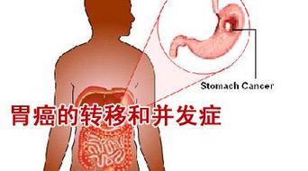 肺腺癌晚期转移小脑和骨头有中医可以治疗吗?