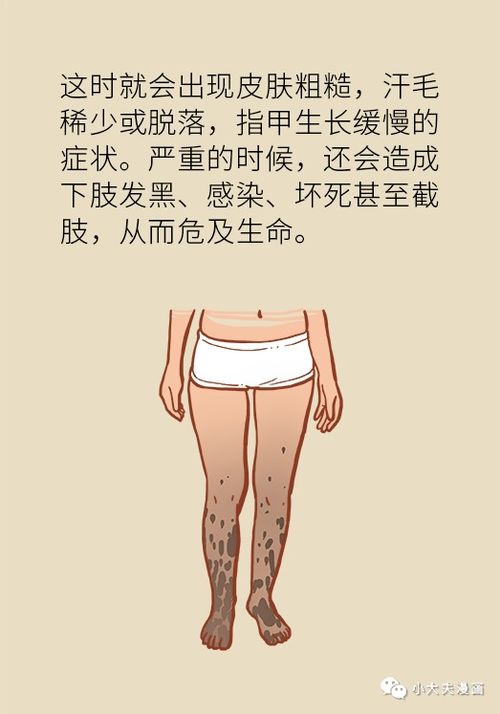 爸妈腿脚不好,除了缺钙,有可能是这个病在发信号