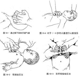 险 父母看电视学心肺复苏救了儿子一命 么么亲子网