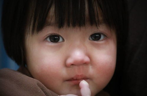两岁女孩得怪病不知疼痛,咬掉自己手指甲却不哭不闹