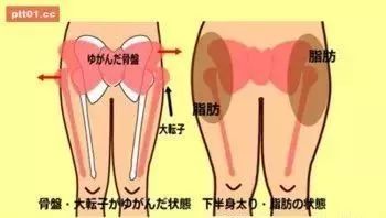 只要这3招,就可以纠正由姿势不良导致骨盆凸出变成大屁股 