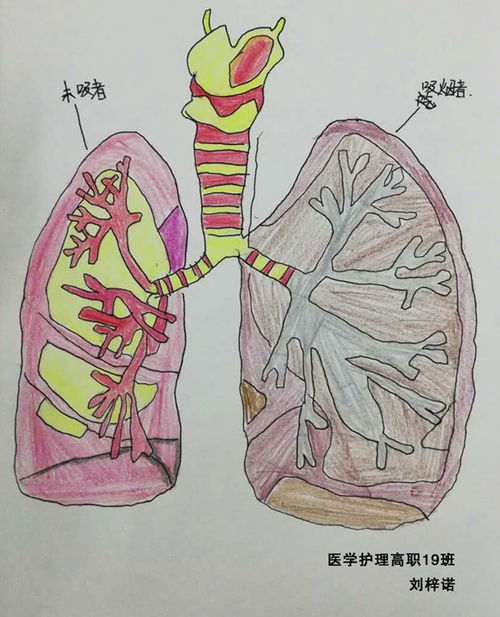 肺部解剖绘图 信息图文欣赏 信息村 K0w0m Com