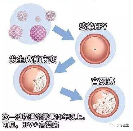 名医访谈 HPV常见问题解答