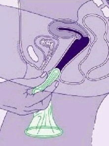 女人的阴道能收容多大的丁丁？