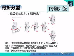 踝关节损伤毕业论文