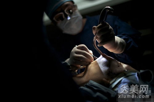 五名韩国模特接受血腥整容手术 
