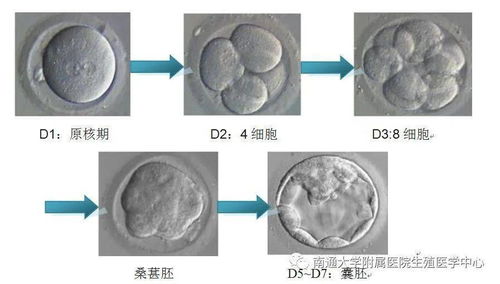 试管婴儿 胚胎移植篇之一鲜胚vs冻胚